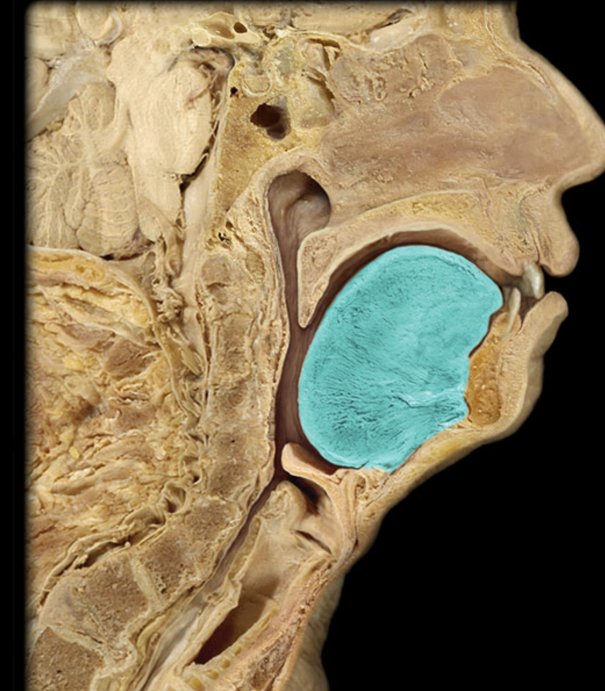 term image