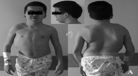 <p>What is the pathology shown?</p>