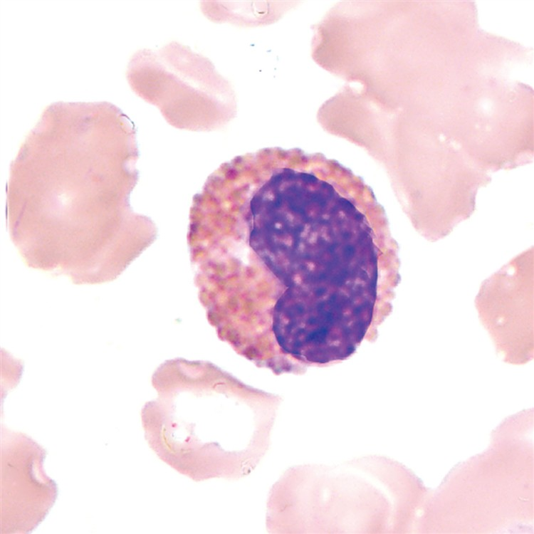<p>what is an eosinophilic metamyelocyte?</p>