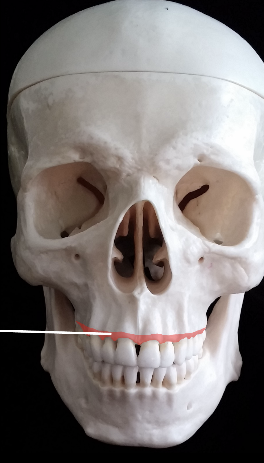 <p>What is the red region highlighted on the maxillary bone?</p>