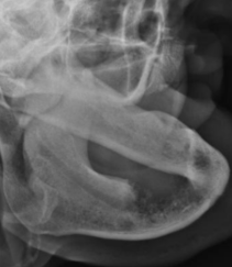 <p><span style="background-color: transparent;">Mandible - Axiolateral OBL</span></p>