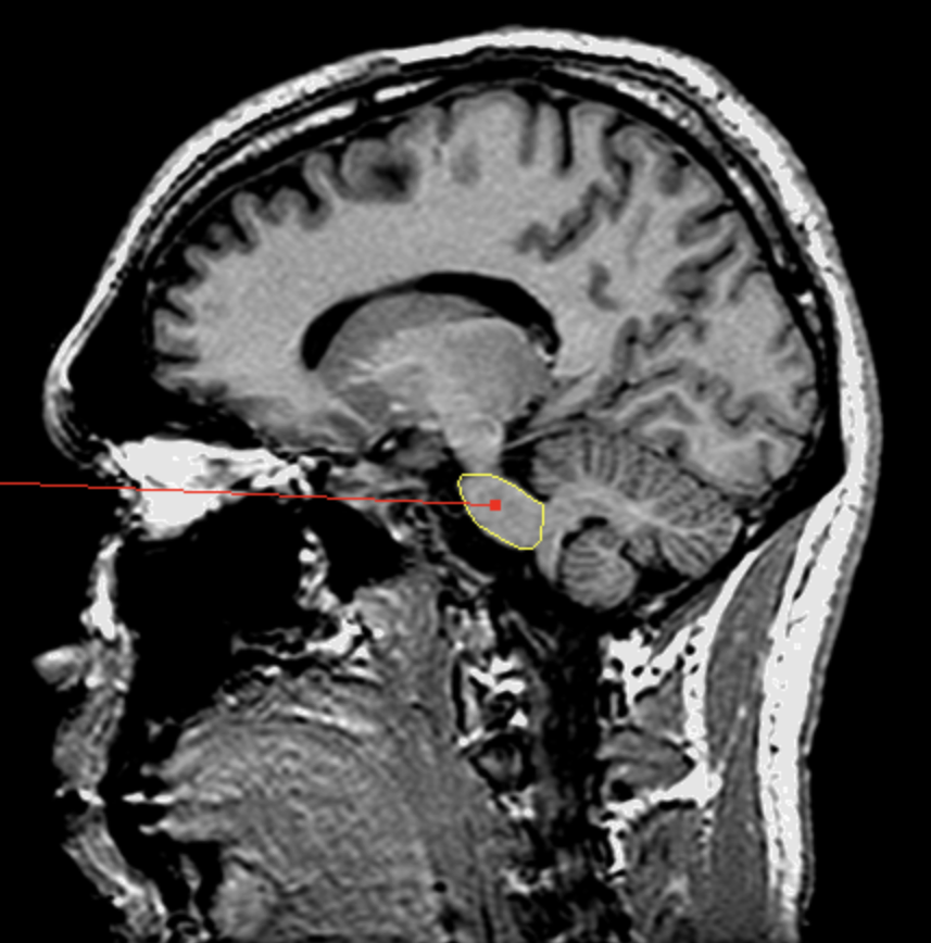 <p>What is the area highlighted called?</p>