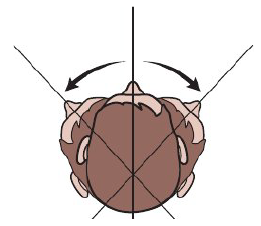 <ul><li><p>Patient can rotate head for easier access</p></li><li><p>Away, towards, or straight ahead</p></li></ul><p></p>