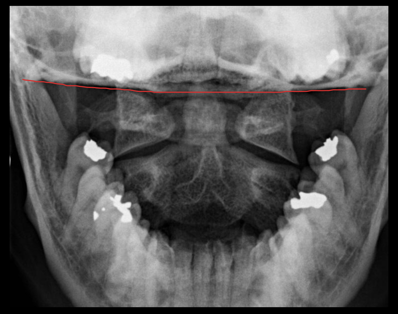 <p><span>颅底</span></p>