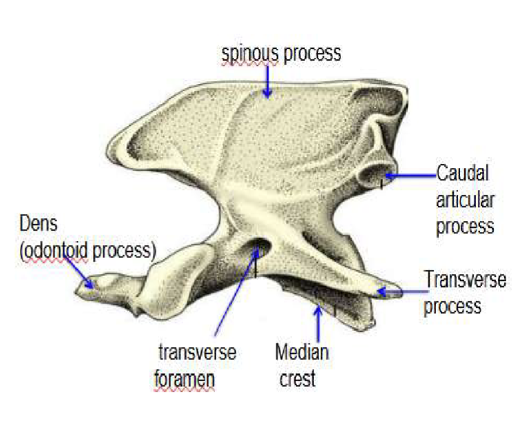 <p>What type of spine bone is this?</p>