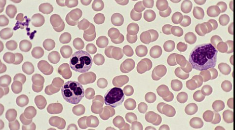 <ul><li><p>red/white cells in fluid matrix </p></li><li><p>found in blood vessels </p></li><li><p><strong>FUNCTION </strong>→ transport nutrients, waste and gases </p></li></ul><p></p>