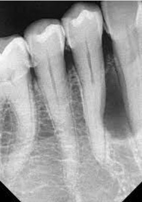 <p>Provide two differential diagnosis</p>