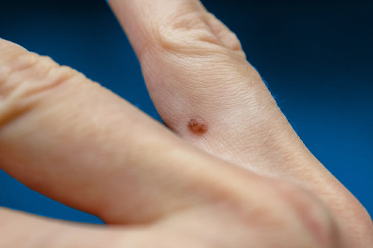 <p>¿Qué ayuda a prevenir la vacuna contra el VPH?</p>