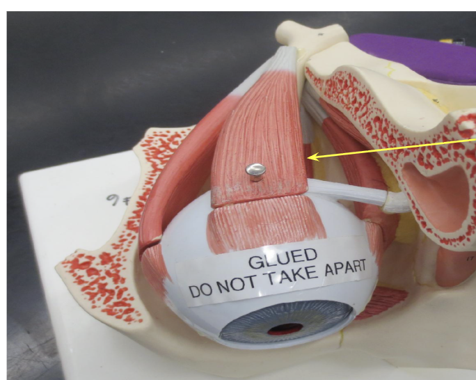 <p>What Muscle is this?</p>