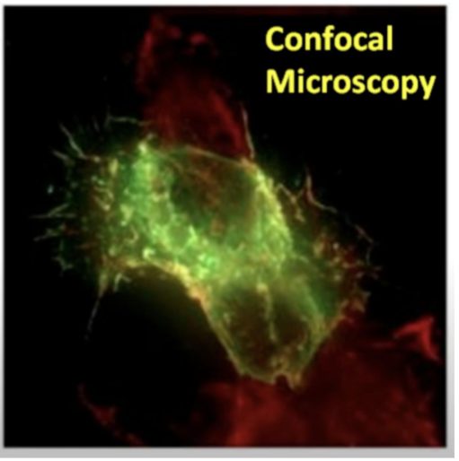 <p>Similar to fluorescence microscopy, confocal microscopy uses fluorescent labels. confocal microscopy provides a means of rejecting the out-of-focus light from the detector such that it does not contribute blue to the images being collected. It generates 3D images by stacking serial optical sections</p>