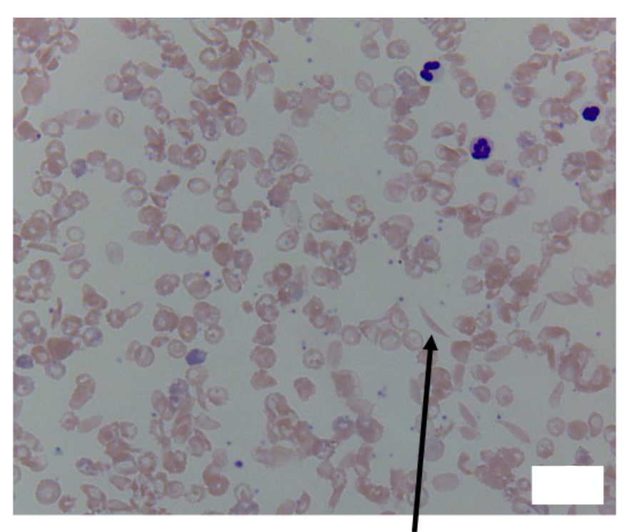 <p>What<br>1 </p>
