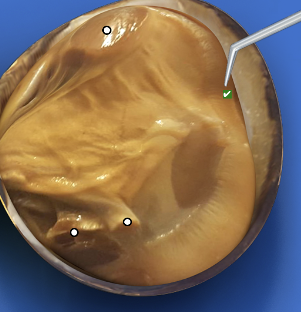 <p>What structure is this pointing to?</p>