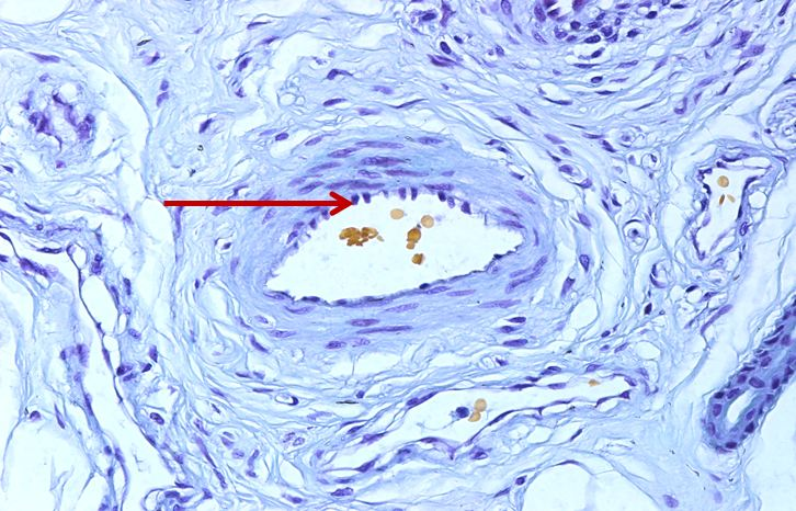 <p>Biểu mô gì ?</p>