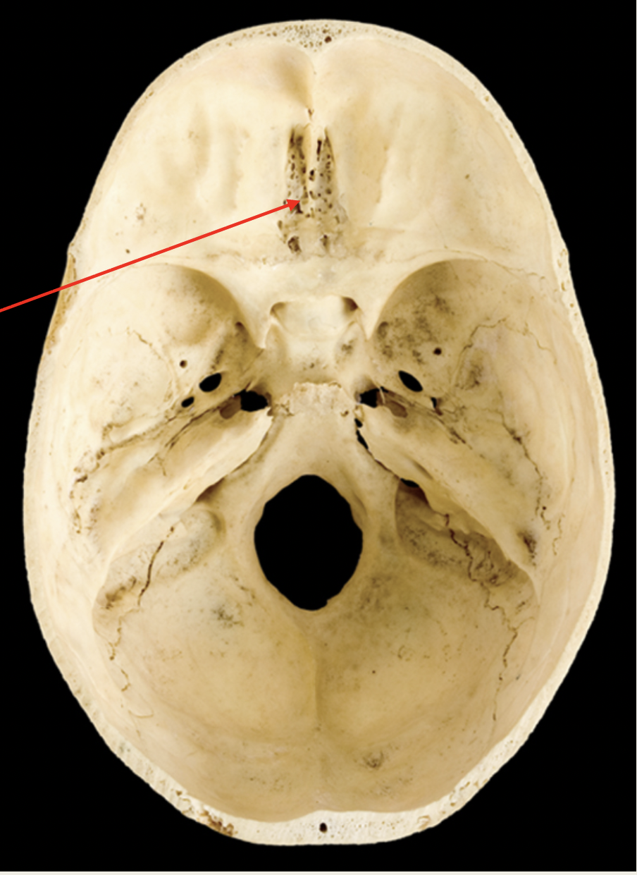 <p>Olfactory</p><p>Nerve (I)</p><p>■ Function: XX of</p><p>XX (XX)</p><p>■ Passes through</p><p>XX XX of XX XX</p>