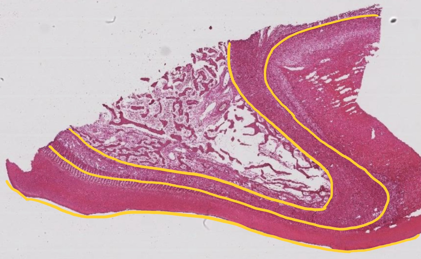 <ul><li><p>epidermal component (modified skin)</p><ul><li><p>outer insensitive part</p></li><li><p>dead &amp; non-vascular</p></li></ul></li><li><p>dermal component</p><ul><li><p>inner sensitive part</p></li><li><p>living &amp; vascular</p></li></ul></li></ul><p></p>