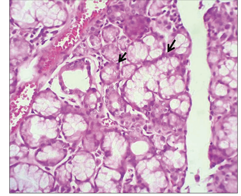 <p>what is the black arrow pointing at</p>