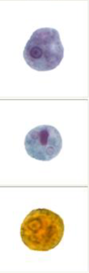 <p>small E. histo: chromatid bodies with compact karyosome</p>