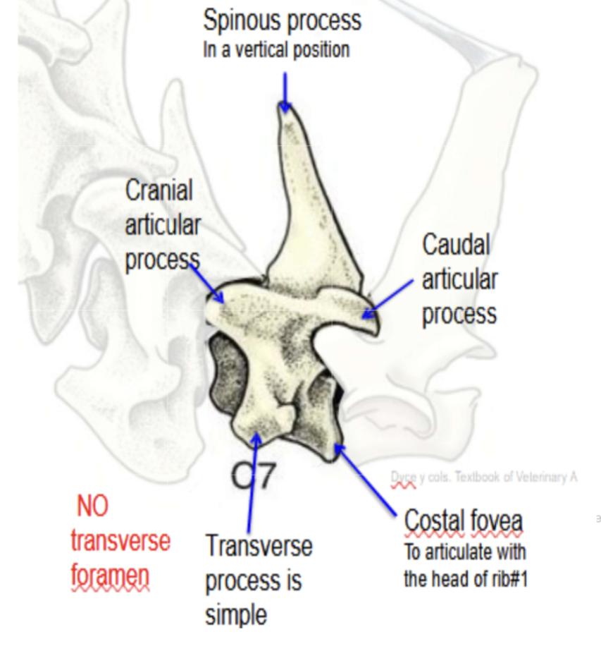 <p>What type of spine bone is this?</p>