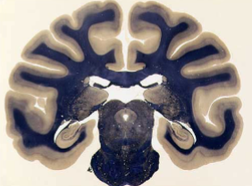 <p>stains <strong>myelin</strong> black or blue in white light</p>