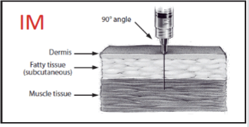 <ul><li><p>90 degree angle </p></li><li><p>into the muscle tissue </p></li></ul><p></p>