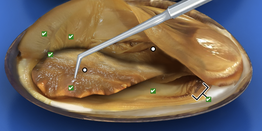 <p>What structure is this pointing to?</p>
