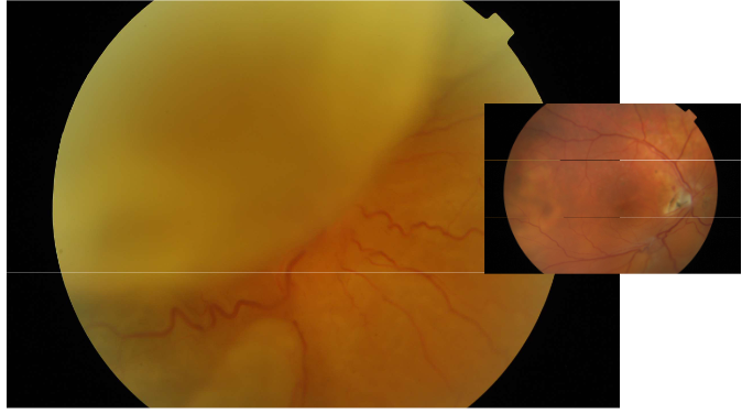 <p>What is this condition?</p>