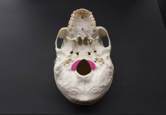 <p> what is the highlighted region next to the foramen magnum? </p>