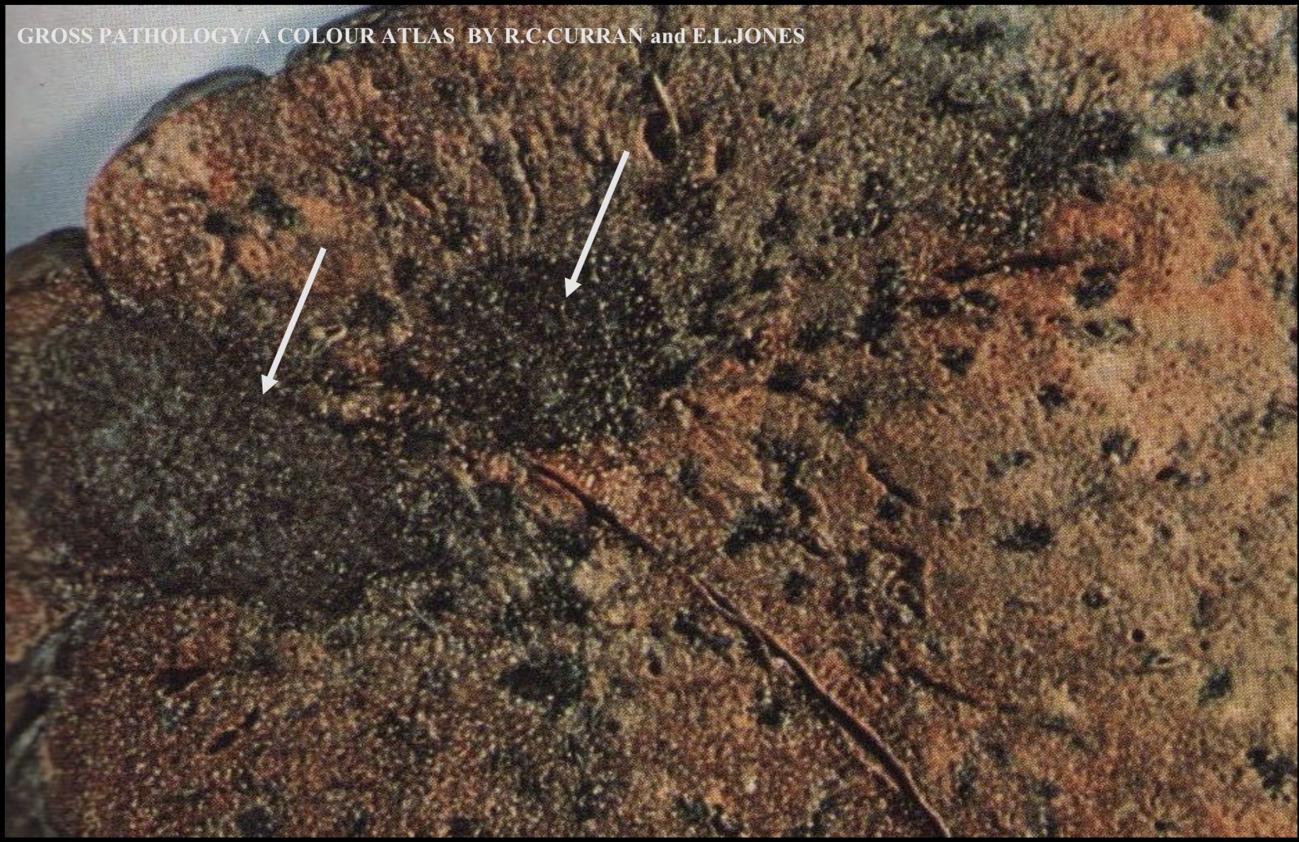 term image