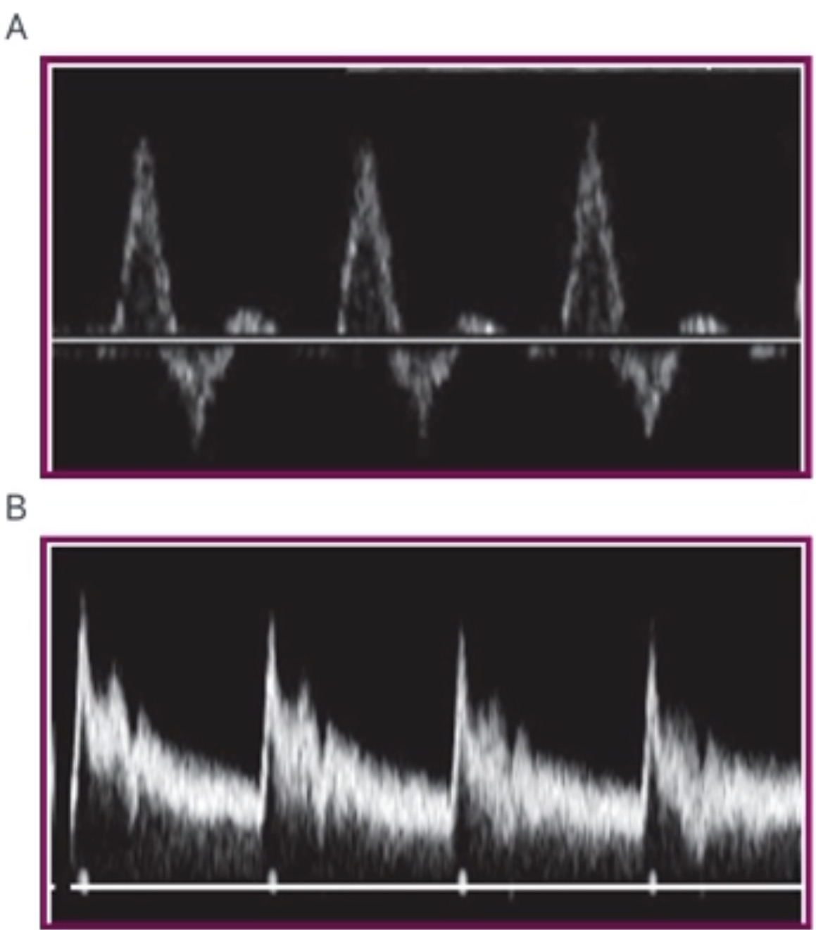 <p>What image is higher resistance?</p>