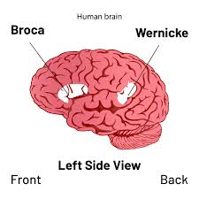 Wernickes område