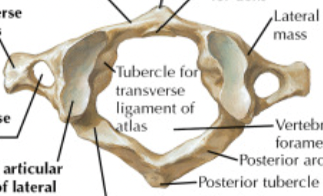 <p>what part of the vertebral column is this bone from and in what view?</p>