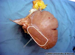 <p>what area of the liver is being highlighted in the image? </p>