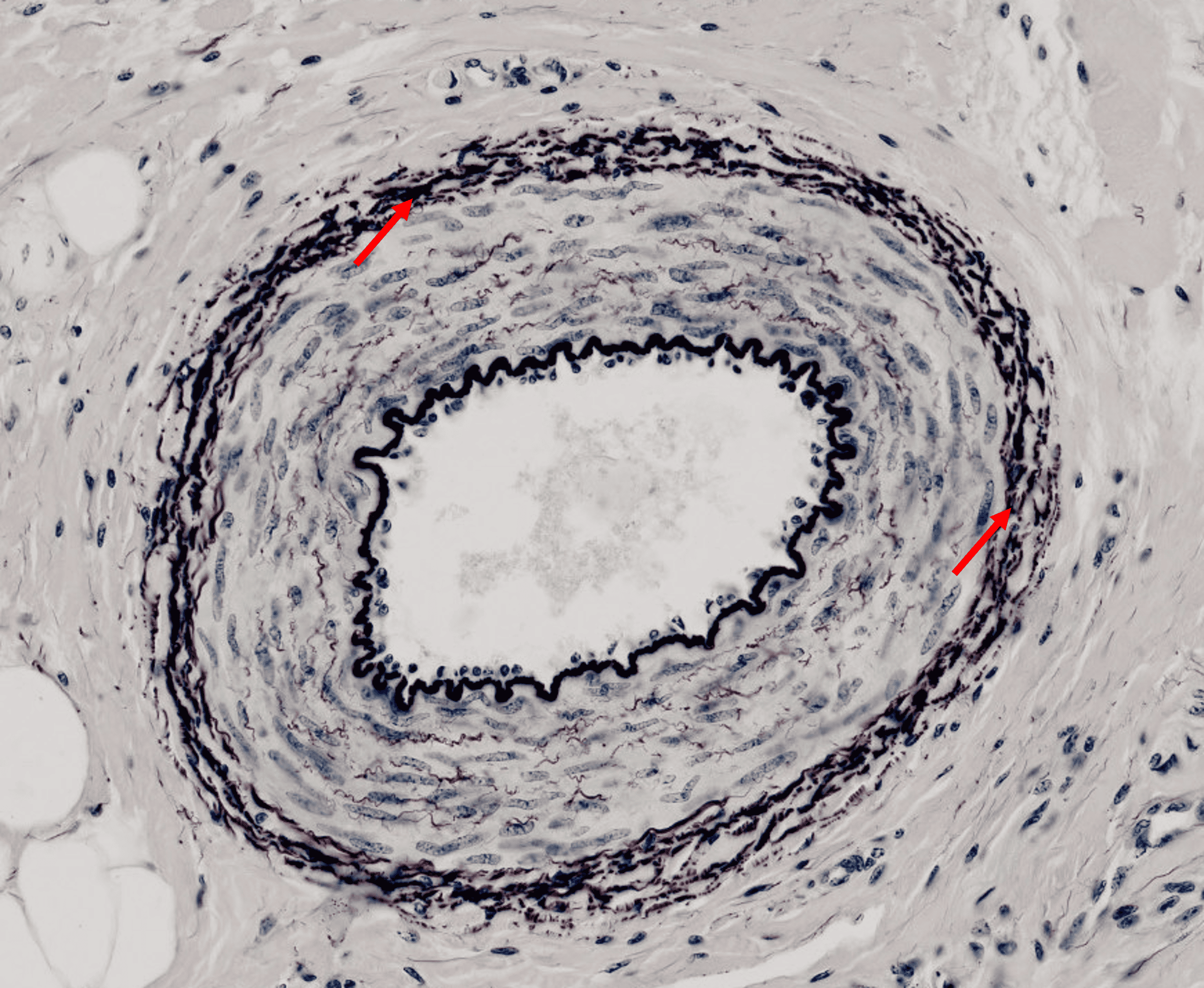 term image