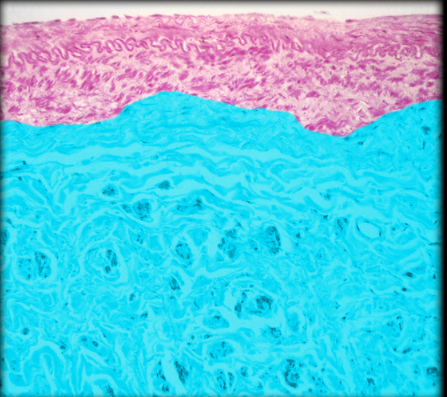 term image