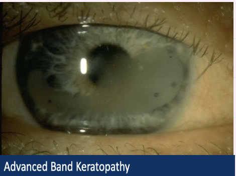 <p>Describe and give diagnosis </p>