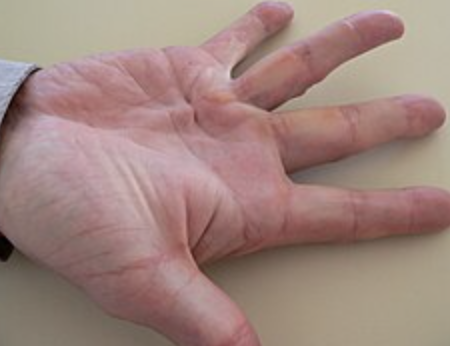 <p>What is this? What is it a sign of?</p>