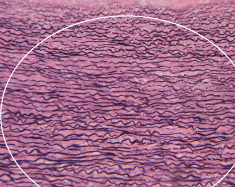 <p>dense elastic connective tissue</p>