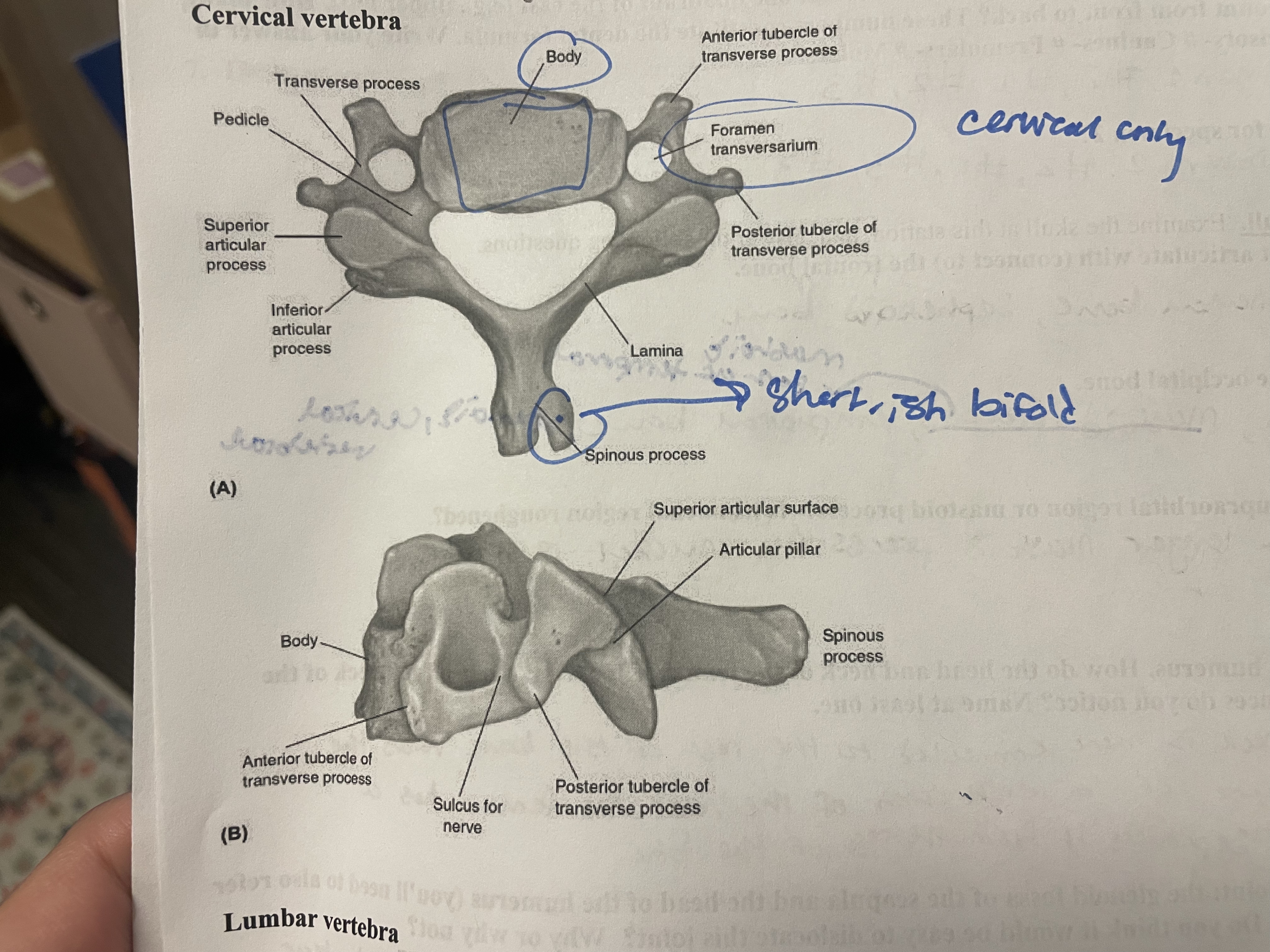 <p>foramen transversarium </p><p>shortish, bifolded spinous process </p>