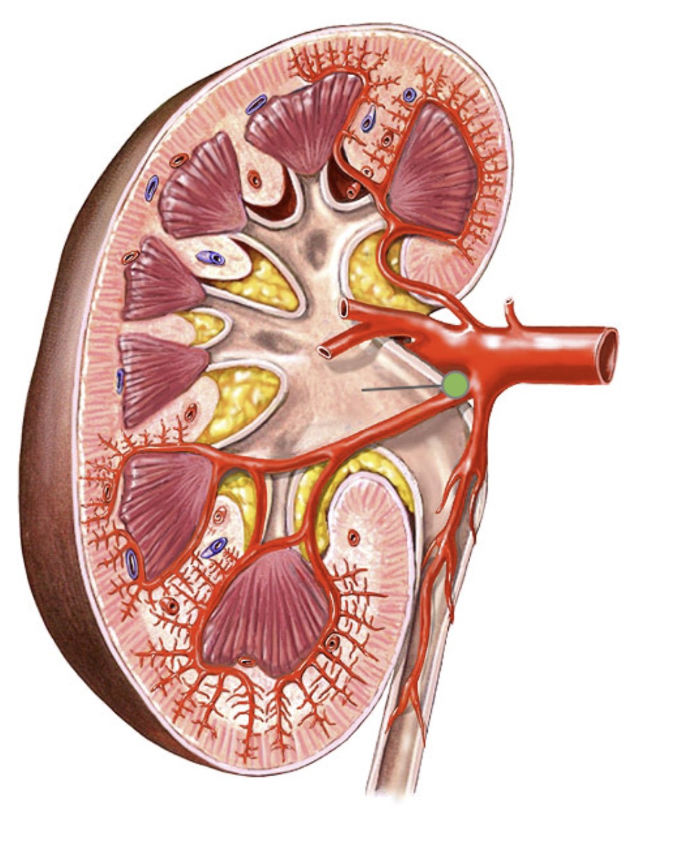 <p>Which part of the kidneys:</p><ul><li><p>Center of kidney, formed from major calyx</p></li></ul><p></p>