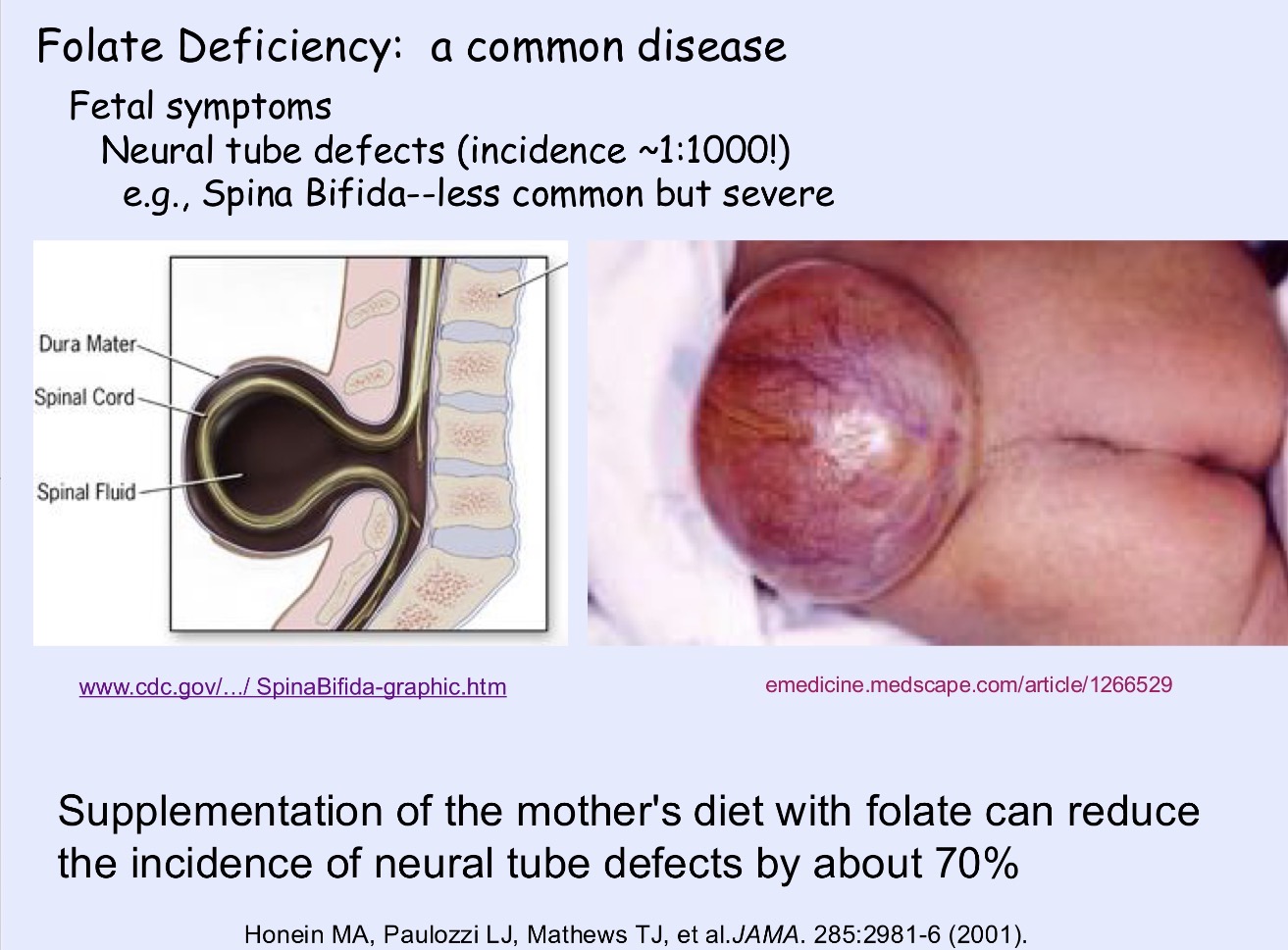 <p>Pregnant women are advised to take B9 because adequate folate intake helps prevent neural tube defects in the fetus, such as spina bifida</p>