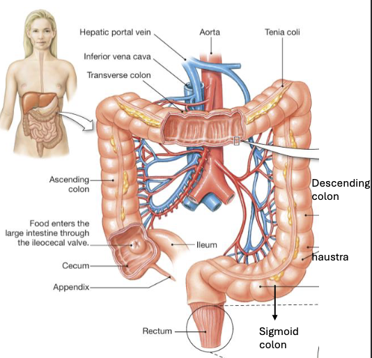 <ul><li><p>Chyme enters through the ileocecal valve which is tonically contracted, but relaxes in response to gastroileal reflex when the stomach empties</p></li><li><p>The large intestine is divided into seven regions: cecum (pouch containing the appendix), ascending colon, transverse colon, descending colon, sigmoid colon, rectum, and anus</p></li><li><p>Structurally, it is characterized by haustra (pouch-like segments) formed due to discontinuous arrangement of the longitudinal muscle layer (taeniae coli) in the muscularis externa</p></li></ul><p></p>