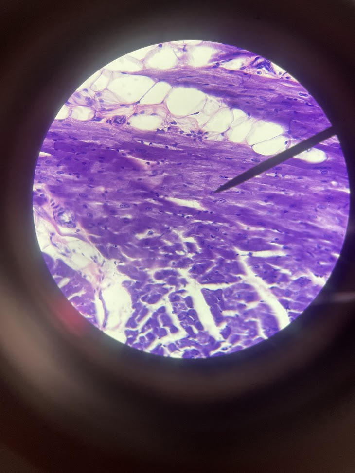 <p>tissue type + structure b/w cells</p>