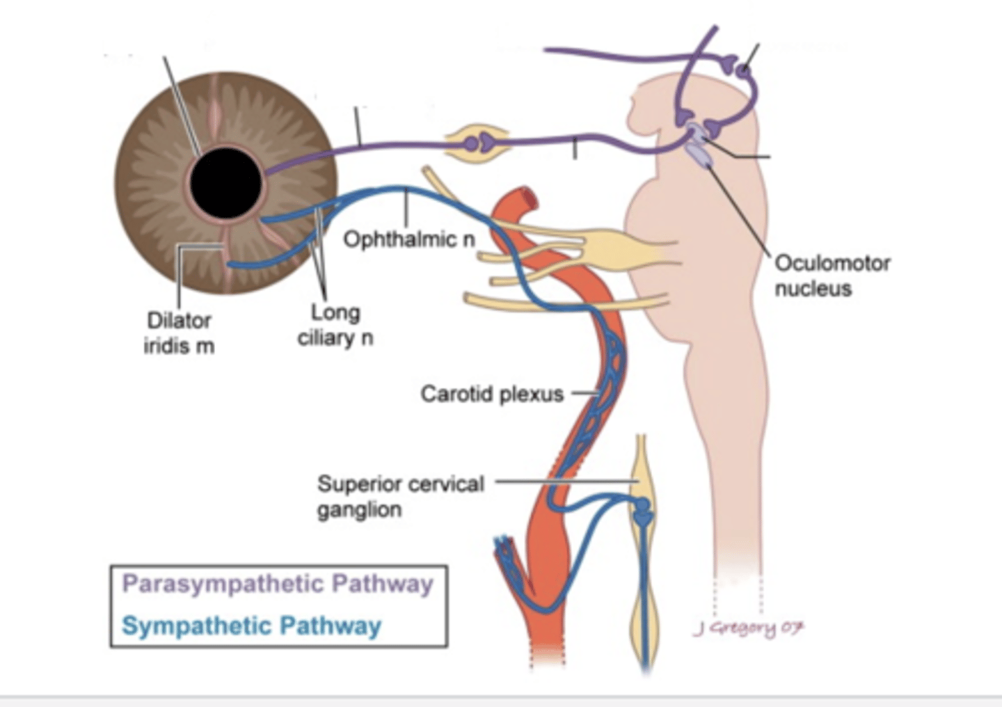 <p>- PARASYMPATHETIC PATH</p><p>- retina before optic tract, detects light</p><p>- in pupillary reflex reaction, optic nerve bypasses LGN, does not synapse there, goes straight to pretectal nucleus and crosses afterwards</p><p>- synapses on EW nucleus</p><p>- travels along CN3 to ciliary ganglion</p><p>- short ciliary nerve to iris sphincter</p>