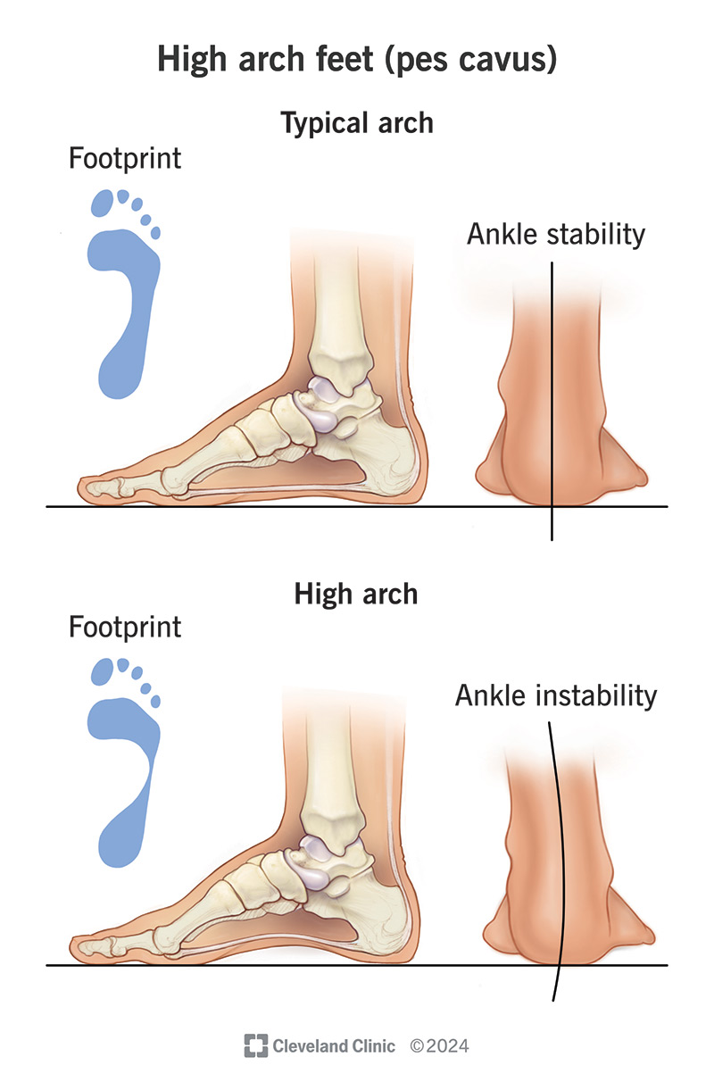 <p>What injury / condition? </p>
