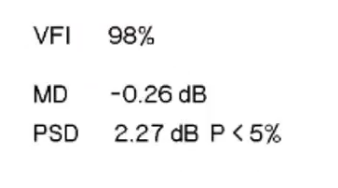 <p>mathematical summaries of all sensitivity values </p><p>VFI: visual field index- approx 100% in normal fields, and approaches 0% in perimetrically blind fields</p><p>less affected by cataracts and to provide imporved correspondance to ganglion cell loss compared with MD </p>