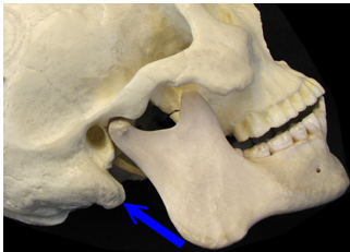 <p>What is the blue arrow pointing to? Is it an origin/insertion, and for what muscle?</p>