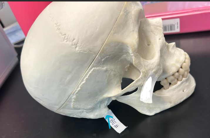<p>ID skull region</p>