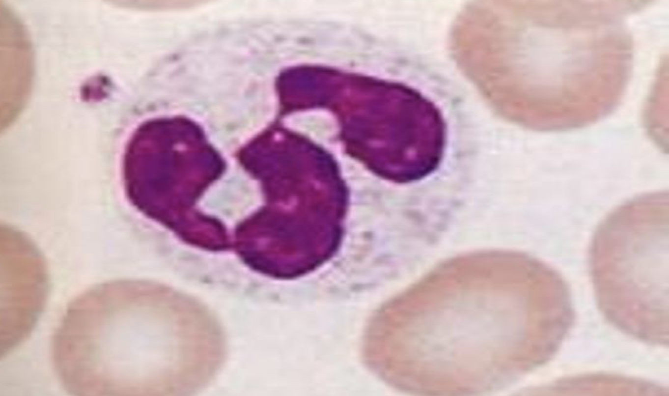 <p>What type of Leukocyte</p>