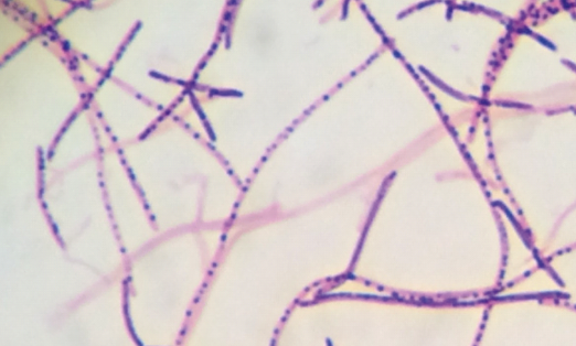<p>“fungi” /// “filaments”</p>