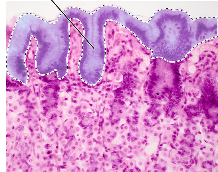 knowt flashcard image